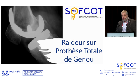 Raideur du genou post PTG 