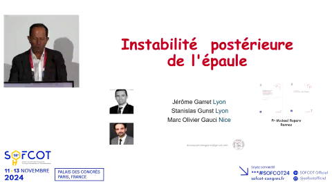 Conférence d'enseignement : Instabilité postérieure de l'épaule - définition et prise en charge 